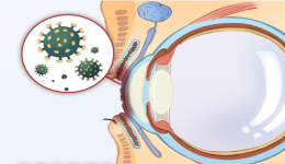 农忙时节，当心被植物划伤眼睛导致真菌性角膜炎