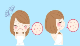 刷酸焕肤，战痘有方，只留青春不留痘