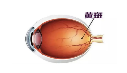 “黄斑病变”是严重威胁视觉健康的眼底疾病 