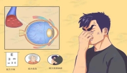 患有高血压 当心“眼中风”