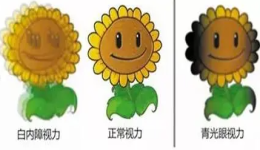 白内障继发青光眼，患者痛苦后果严重