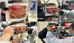 蛇年春节假期，我院眼外伤科全力救治52名眼外伤患者