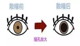 “散瞳”验光配镜对眼睛无害