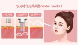 注射微整形，美丽过“双节”