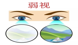 弱视的危害比近视大百倍